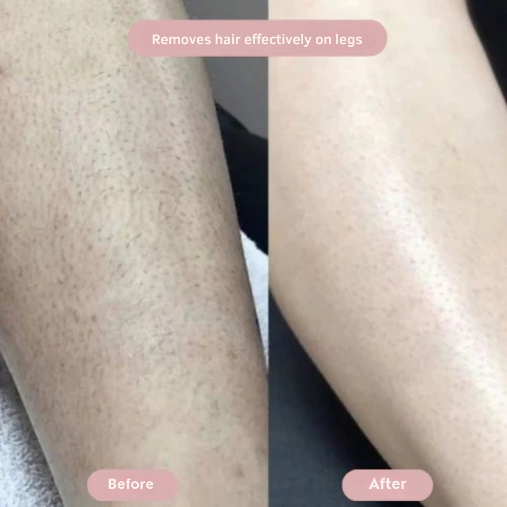 SilkySkin – Effortless intimate shaving, zero irritation