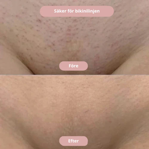SilkySkin – Effortless intimate shaving, zero irritation